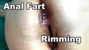 STEPMOM Hairy Ass Pussy. Hairy Asshole anal COUGAR MILF. Amateur Rimjob. Milf Rimming. Hairy Pussy Fuck Close Up Cumshot